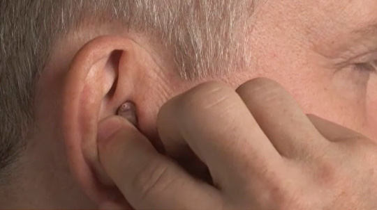 Inserting the device